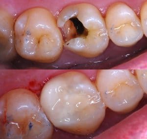 Restorative Dentistry Before & After