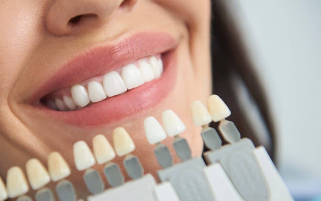 Which Tooth Replacement Option is Best For You?