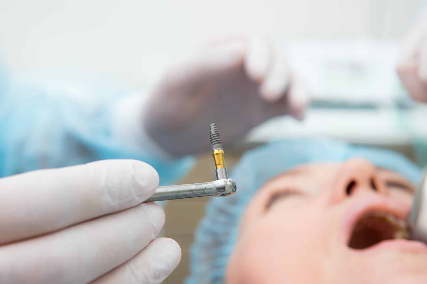 Implant dentist in Charlotte, NC